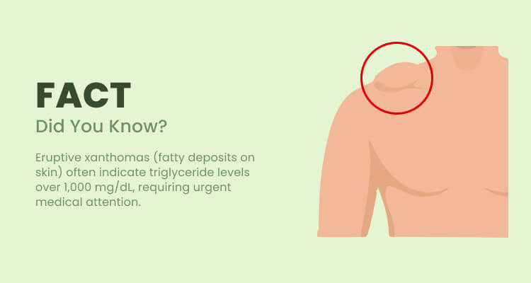 symptoms of high cholesterol